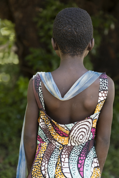 "En vuestra piel". Exposición fotográfica.